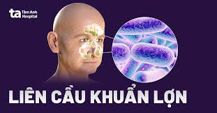 Bệnh liên cầu lợn và các biện pháp phòng tránh